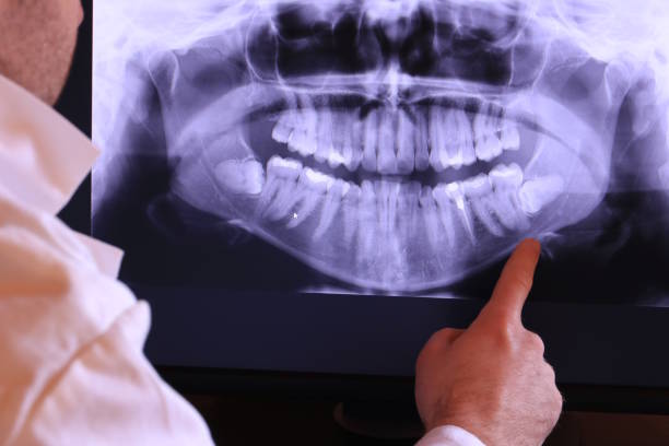 Best Emergency Treatment for Dental Infections or Abscesses in Winchester, NV